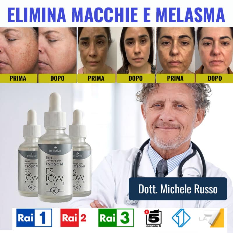 Trattamento naturale per macchie e melasma con ESOSOMI e Dott. Michele Russo.
