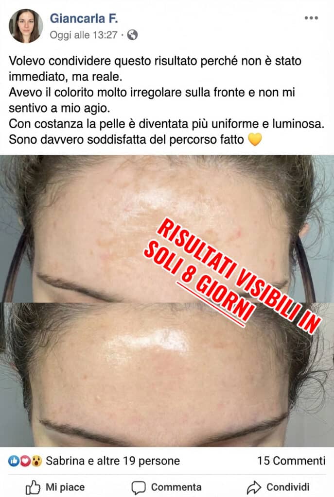 Risultati visibili in 8 giorni con trattamento viso naturale.