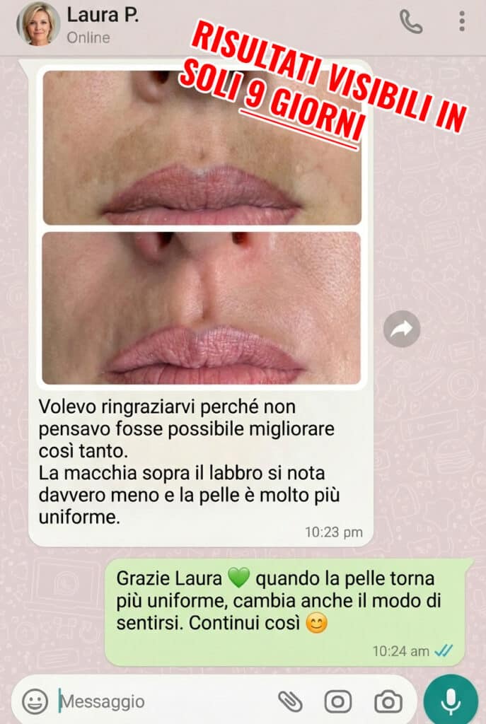Prima e dopo trattamento viso, miglioramento della pelle.