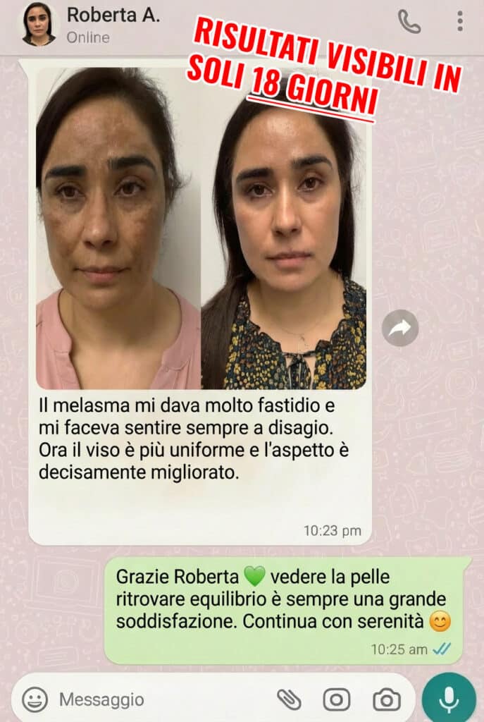 Prima e dopo trattamento viso, miglioramento visibile.