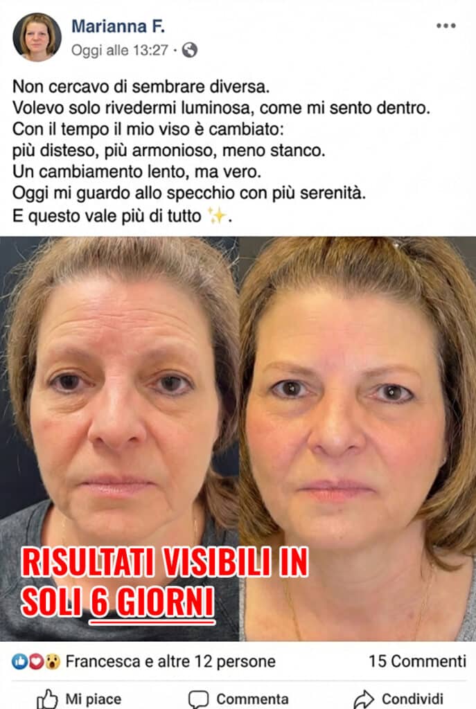 Prima e dopo trattamento viso, miglioramento visibile.