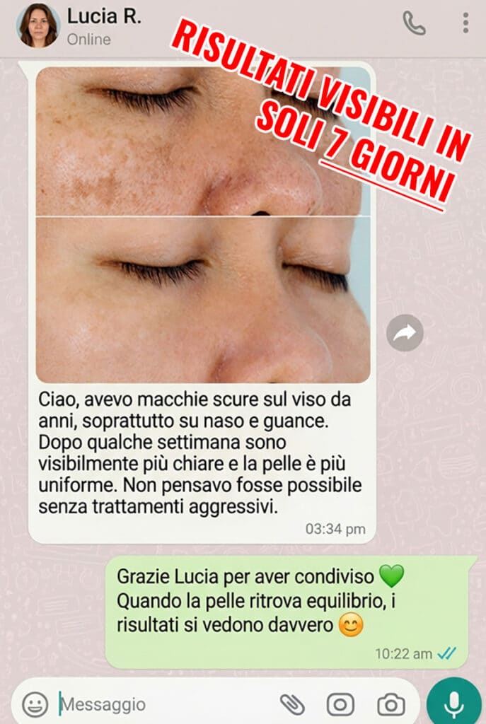 Prima e dopo trattamento viso con macchie scure.