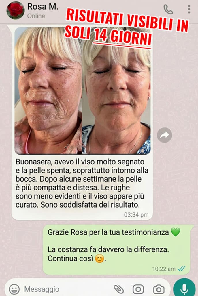 Prima e dopo trattamento viso, miglioramento visibile.