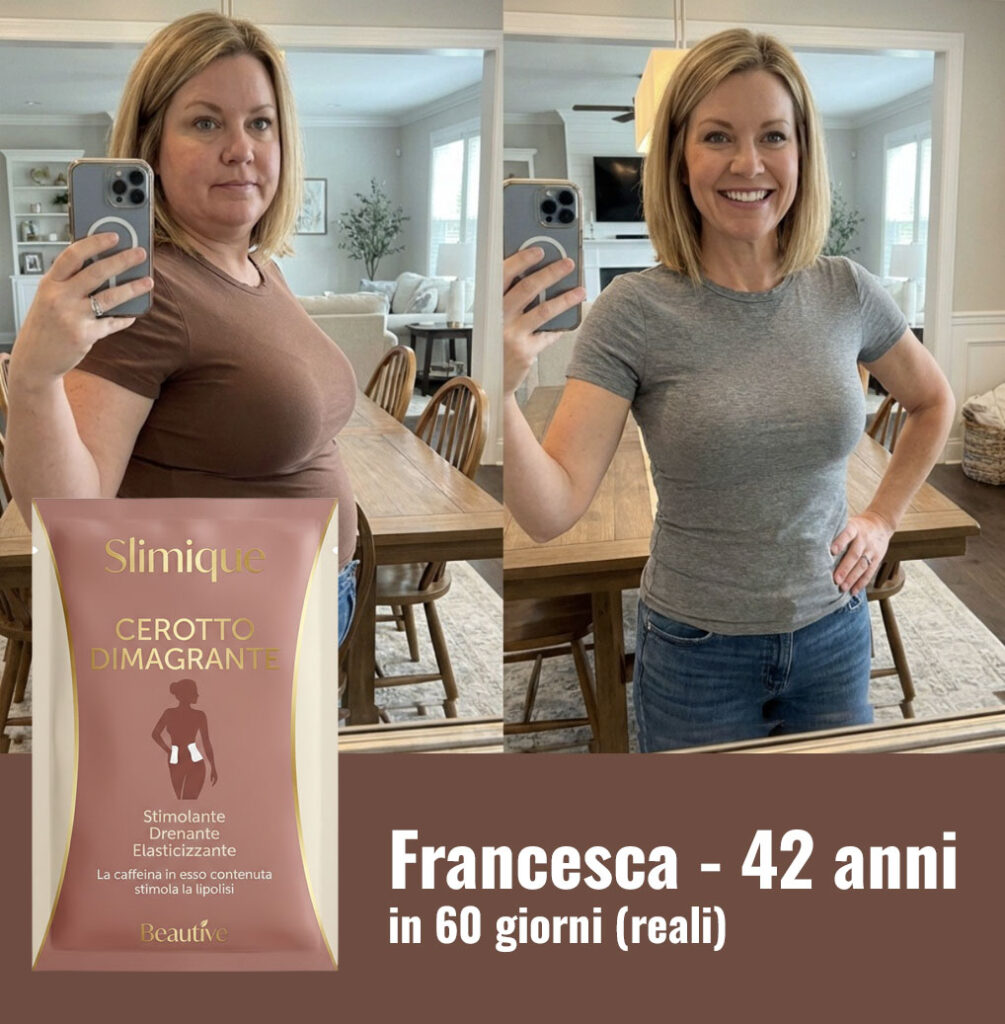 Prima e dopo il trattamento Slimique di Francesca, 42 anni.