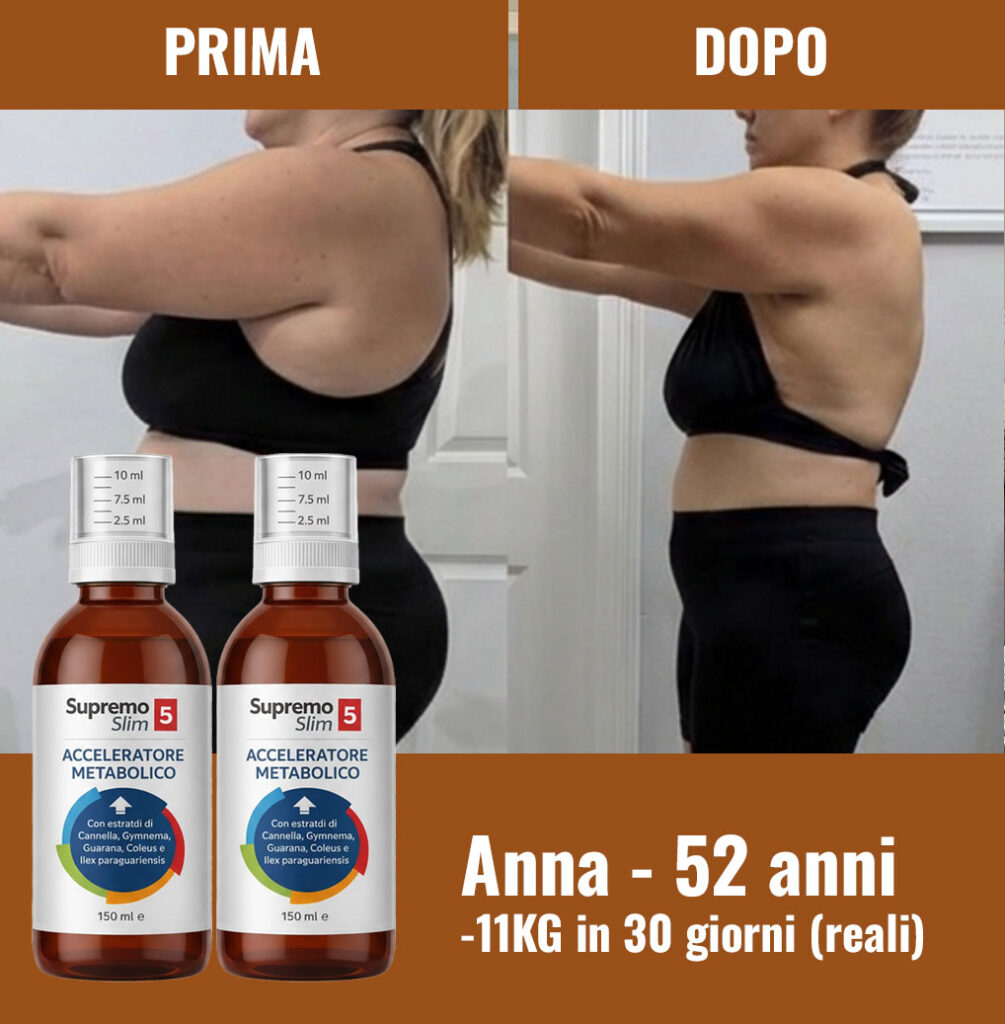 Prima e dopo la perdita di peso di Anna, 52 anni, con Supremo Slim.