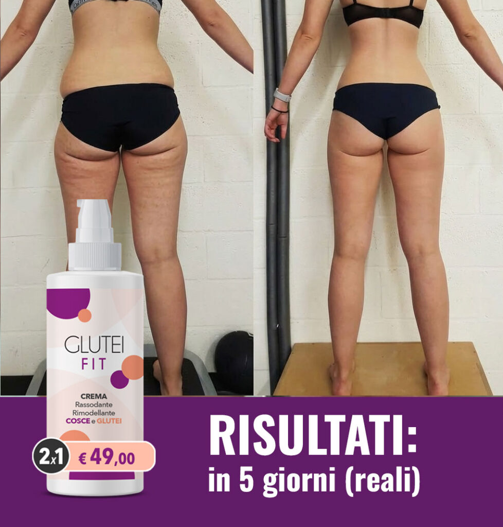 Prima e dopo l'uso di GluteiFit per rassodare i glutei e le cosce.