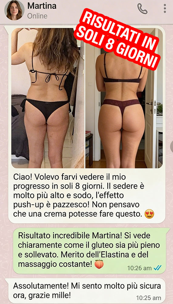 Prima e dopo trattamento di glutei con risultati visibili.