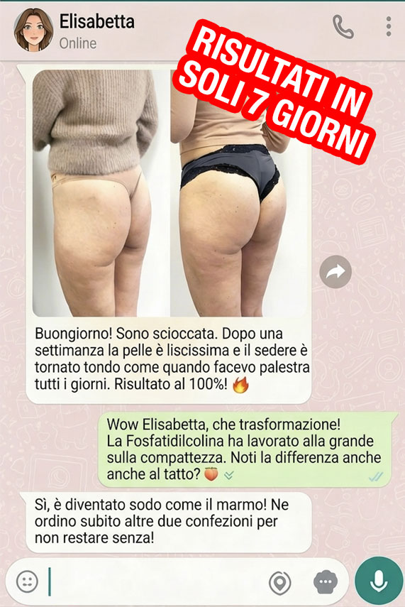 Testimonianza di trasformazione glutei con risultati in 7 giorni.