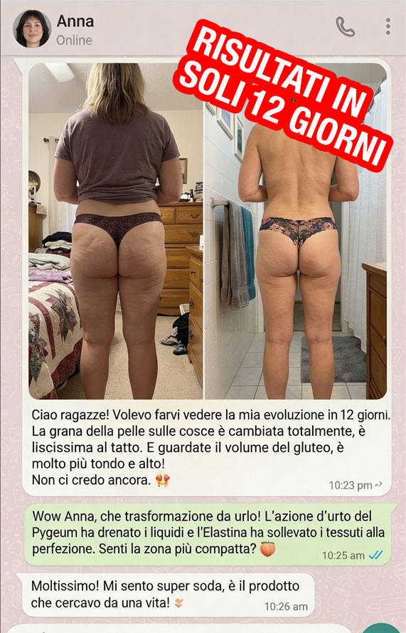 Prima e dopo l'uso di Gluteifit per migliorare i glutei.
