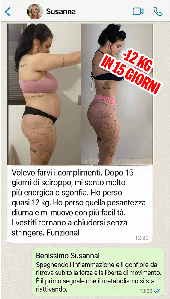 Prima e dopo la perdita di peso di Susanna in 15 giorni.