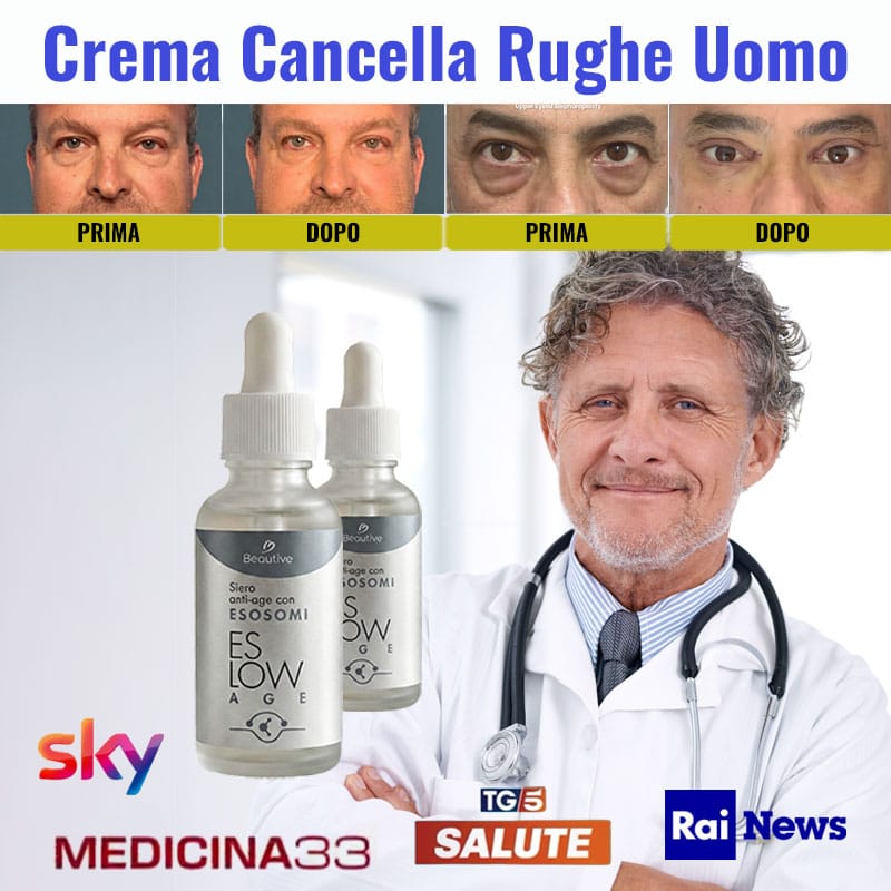 Crema anticaduta uomo Esow Age con risultati visibili.
