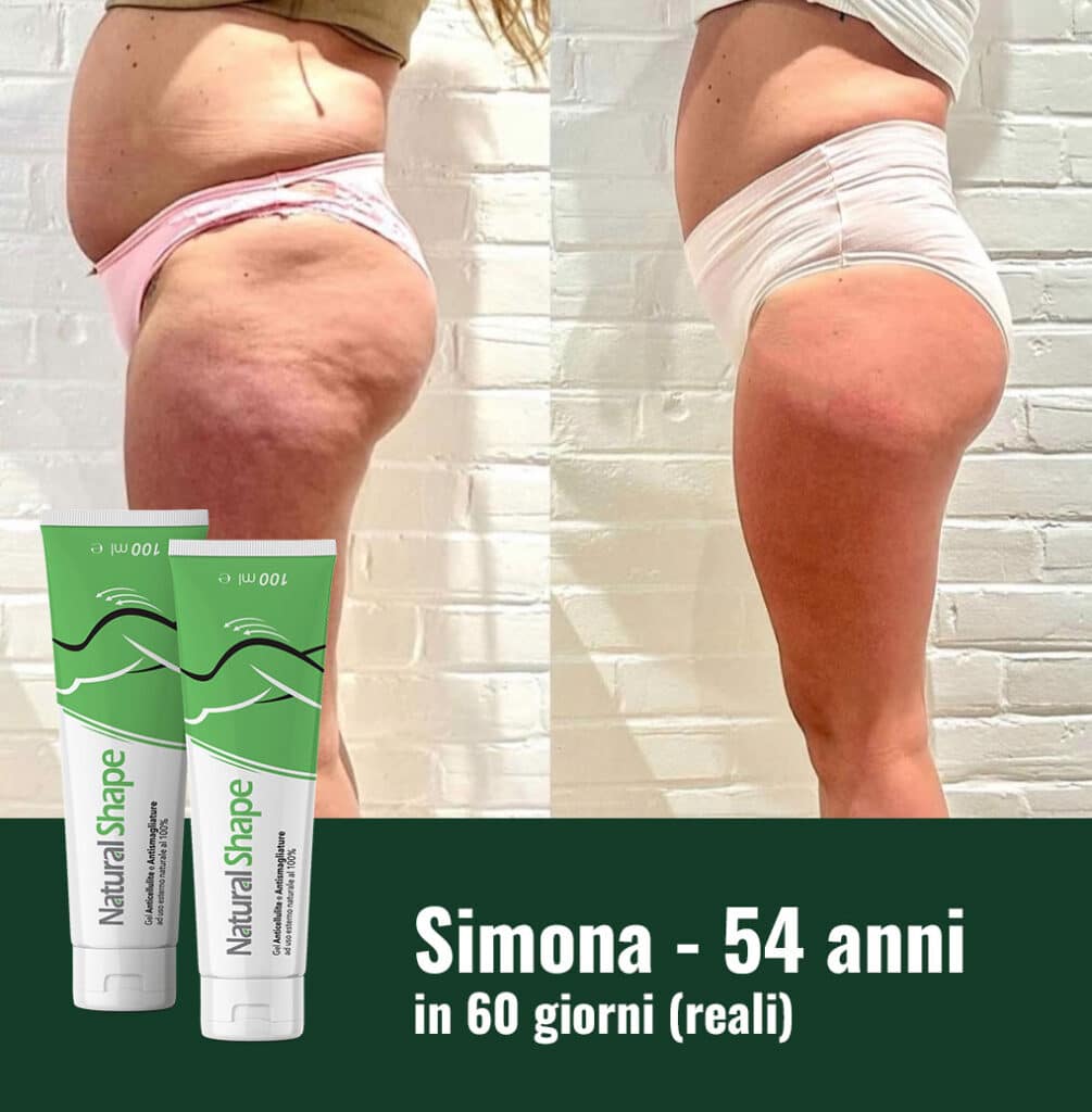 Prima e dopo l'uso di Natural Shape per la perdita di peso.