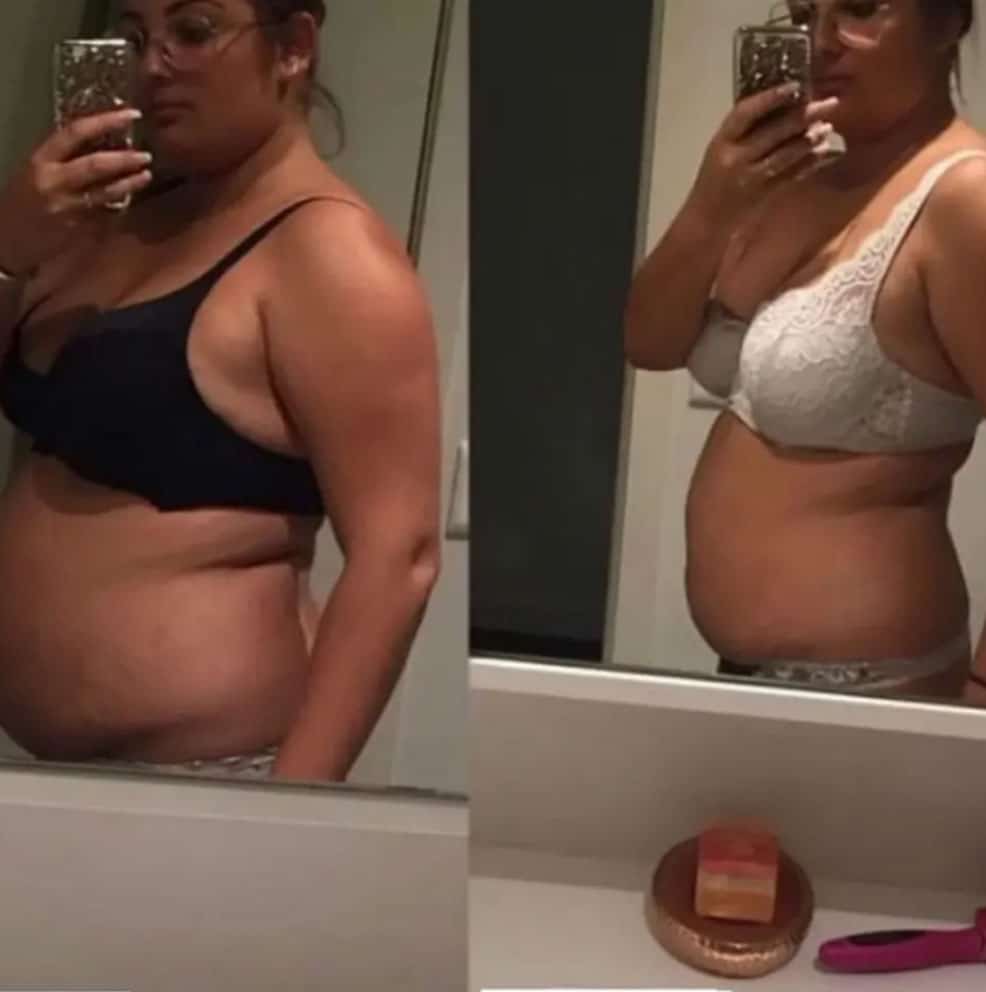 Immagine confronto prima e dopo trattamento Slimique menopausa.