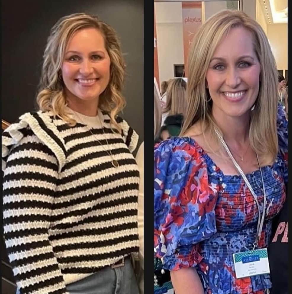 Donna sorridente prima e dopo trattamento menopausa.