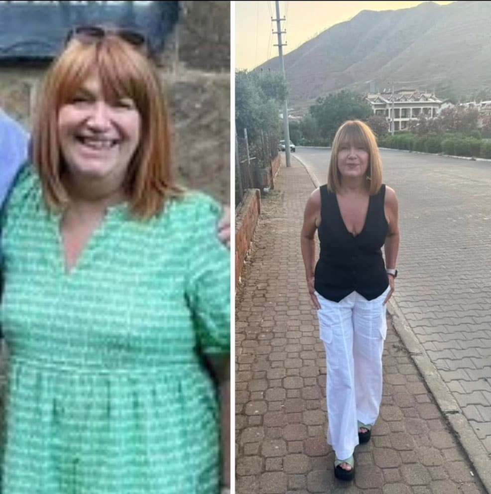Donna prima e dopo la perdita di peso durante la menopausa.