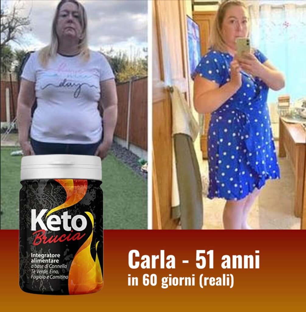Donna di 51 anni prima e dopo 60 giorni di Keto Brucia.