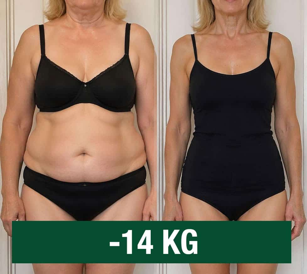 Donna prima e dopo la perdita di peso di 14 kg.