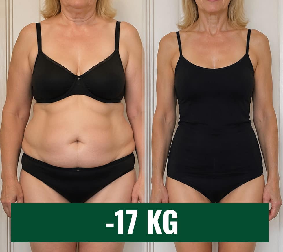 Prima e dopo dimagrimento di 17 kg con Slimique cortisolo.