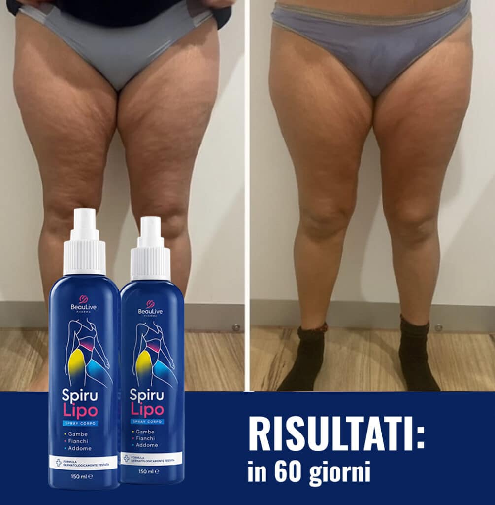 Prima e dopo l'uso di Spirulipo per perdita di peso.