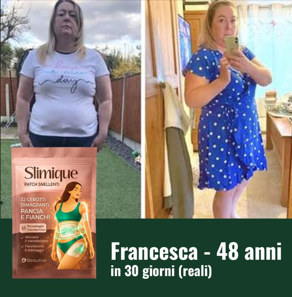 Prima e dopo l'uso di Slimique cortisolo, donna di 48 anni.